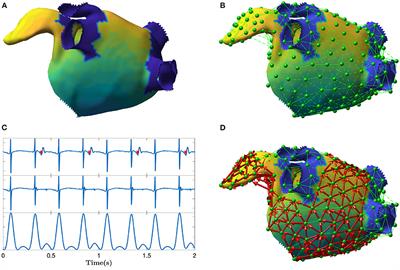 Atrial Flutter Mechanism Detection Using Directed Network Mapping